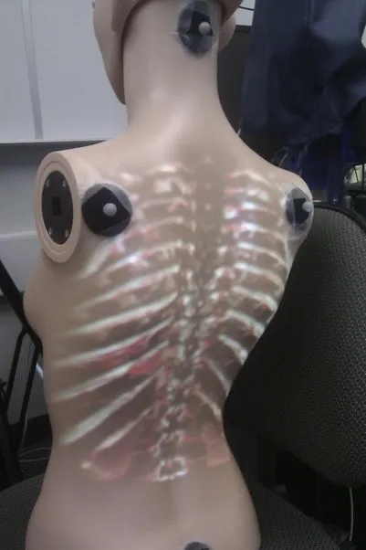 Video: Doctors can now