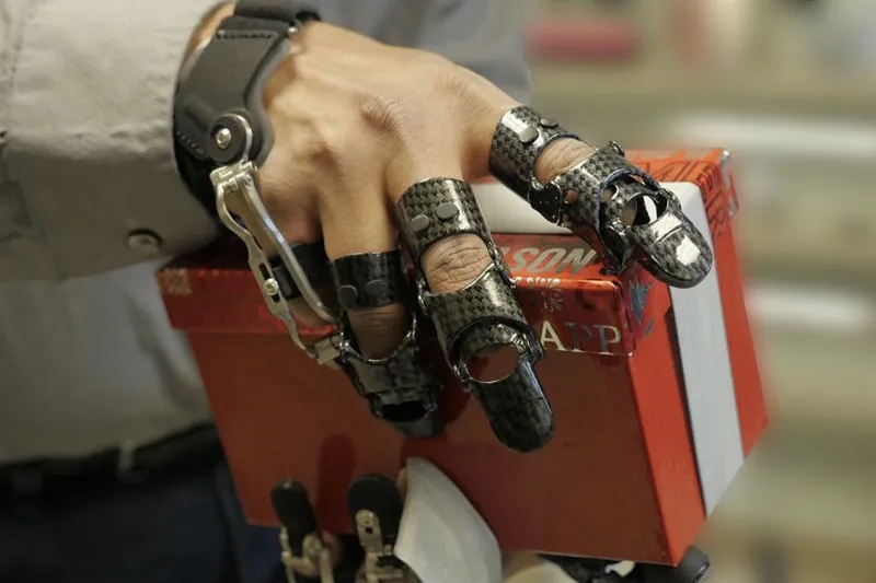 How can these prosthetics make life easier...