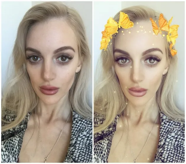 People are getting surgery to look like Snapchat filter