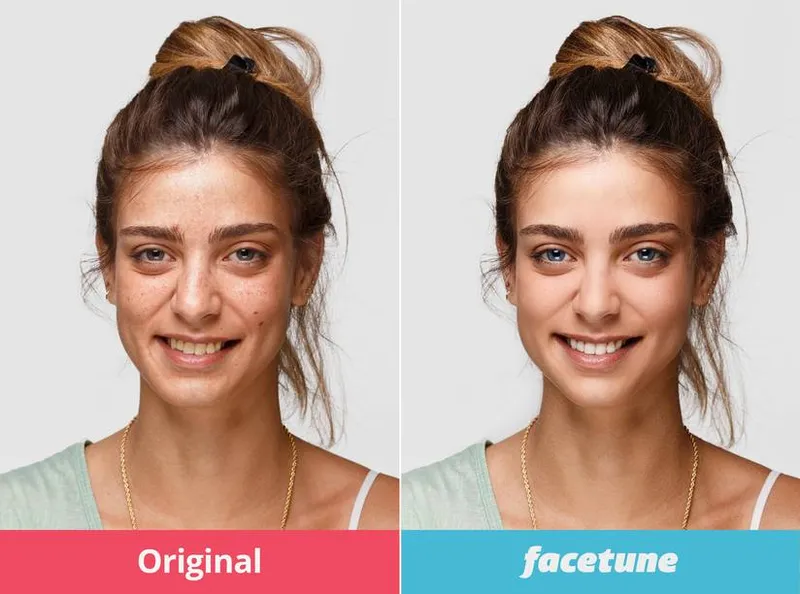 People are getting surgery to look like Snapchat filter
