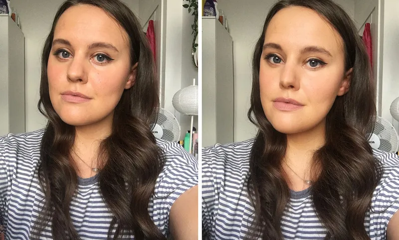 People are getting surgery to look like Snapchat filter