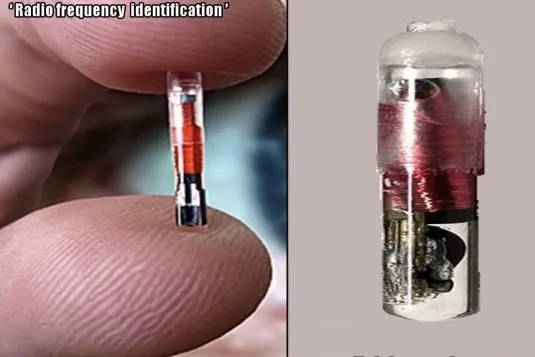 Are you ready to be microchipped? 0